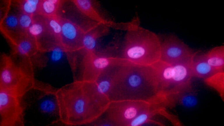 Biogen, Celcuity cancer drug, Mwyngil: Readout Newsletter