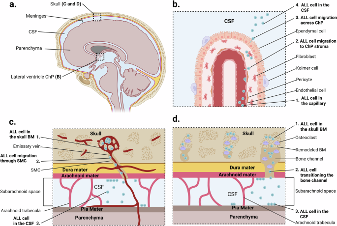 Central nervous system involvement in acute lymphoblastic leukemia: pathogenesis and targeted therapy Central nervous system involvement in acute lymphoblastic leukemia: pathogenesis and targeted therapy