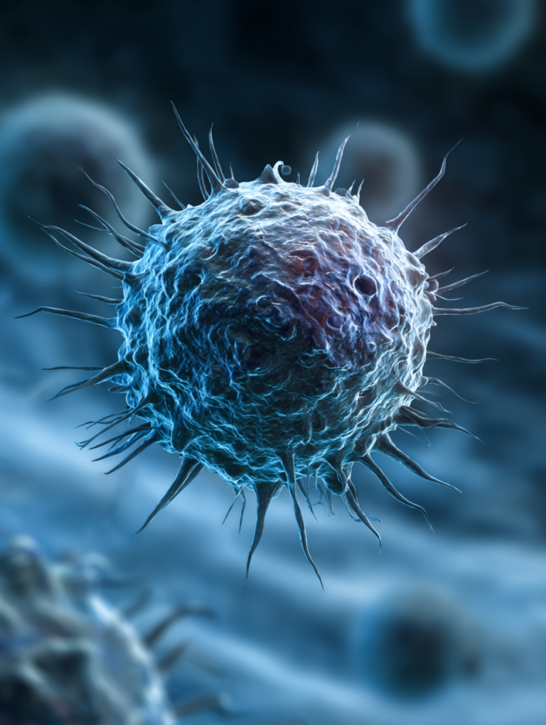 Clinical Outcomes of Acute Pancreatitis in Patients With Multiple Myeloma
