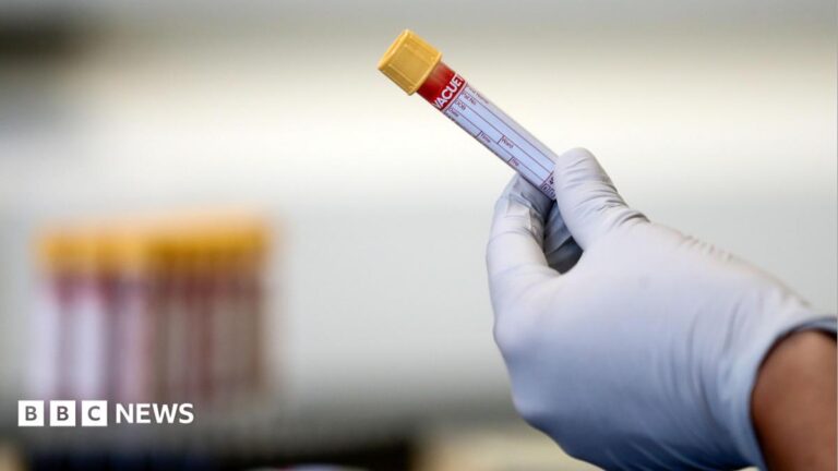 ‘Exciting’ Guernsey UK cancer trial launched A blood sample in a test tube being held up by a hand with a white glove.