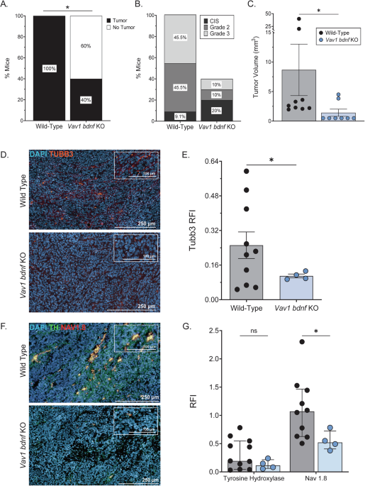 Macrophage-secreted brain-derived neurotrophic factor promotes tumor growth in triple-negative breast cancer by inducing axonogenesis Macrophage-secreted brain-derived neurotrophic factor promotes tumor growth in triple-negative breast cancer by inducing axonogenesis