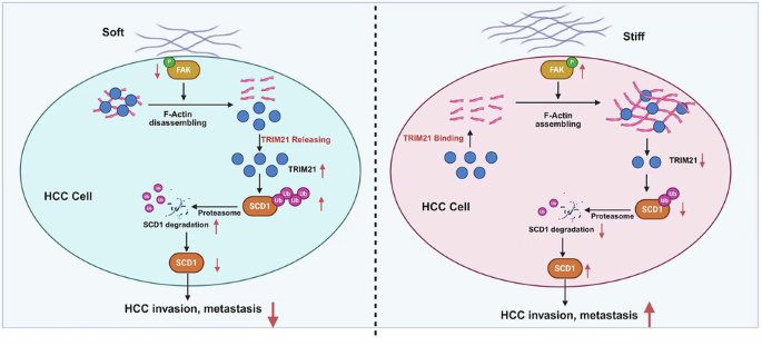 Matrix stiffness drives HCC invasion and metastasis via interfering with TRIM21-mediated SCD1 ubiquitination Matrix stiffness drives HCC invasion and metastasis via interfering with TRIM21-mediated SCD1 ubiquitination