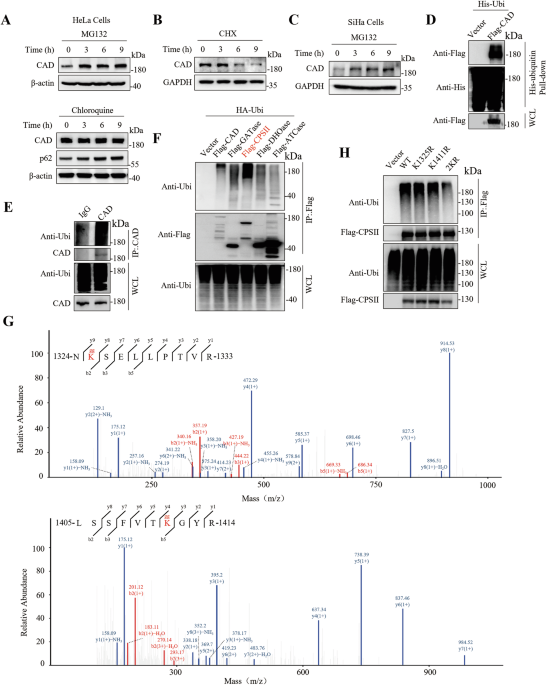 OTUD6A promotes de novo pyrimidine synthesis by deubiquitinating and stabilizing CAD in cervical cancer OTUD6A promotes de novo pyrimidine synthesis by deubiquitinating and stabilizing CAD in cervical cancer