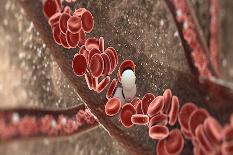 Orelabrutinib Improves Progression-Free Survival in Treatment-Naive CLL/SLL Lymphoma