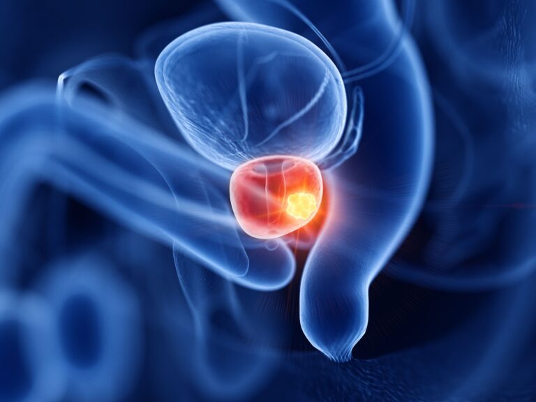 FDA Accepts Daraxonrasib NDA in PDAC: © Sebastian Kaulitzki - stock.adobe.com