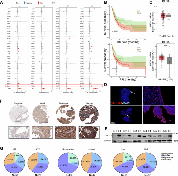 YME1L1 degradation by TRIM21 inhibits bladder cancer proliferation, metastasis, and mitochondrial function YME1L1 degradation by TRIM21 inhibits bladder cancer proliferation, metastasis, and mitochondrial function