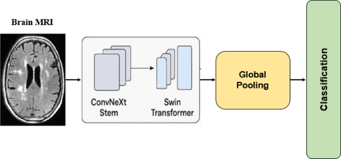A novel hybrid transformer-based framework (H-ConvNeXt–Swin) to classify brain tumors using MRI A novel hybrid transformer-based framework (H-ConvNeXt–Swin) to classify brain tumors using MRI