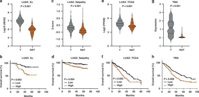 CTPS1 promotes lung adenocarcinoma progression as a targetable vulnerability CTPS1 promotes lung adenocarcinoma progression as a targetable vulnerability
