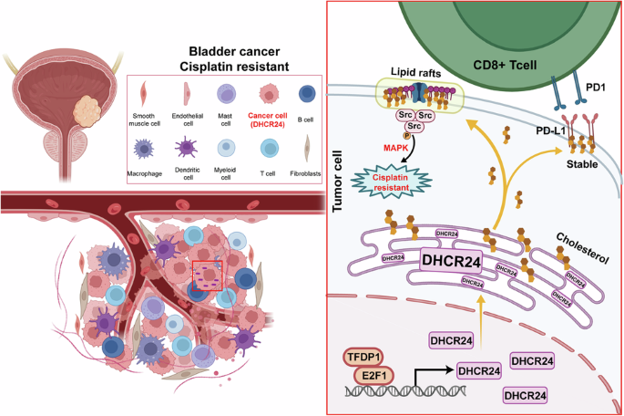 DHCR24+ tumor epithelial cells drive cisplatin resistance in bladder cancer by enhancing cholesterol metabolism to activate lipid raft-associated MAPK signaling DHCR24+ tumor epithelial cells drive cisplatin resistance in bladder cancer by enhancing cholesterol metabolism to activate lipid raft-associated MAPK signaling