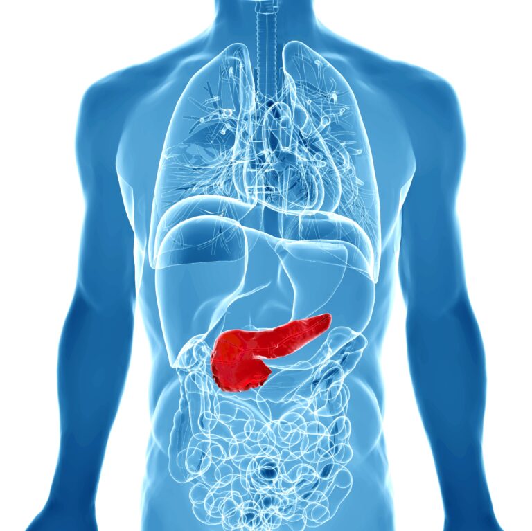 FDA Grants Fast Track Designation to ERAS-0015 for Pancreatic Adenocarcinoma Lizza Hendriks, MD, PhD, discussed why every patient with CNS metastases deserves a multidisciplinary team discussion.