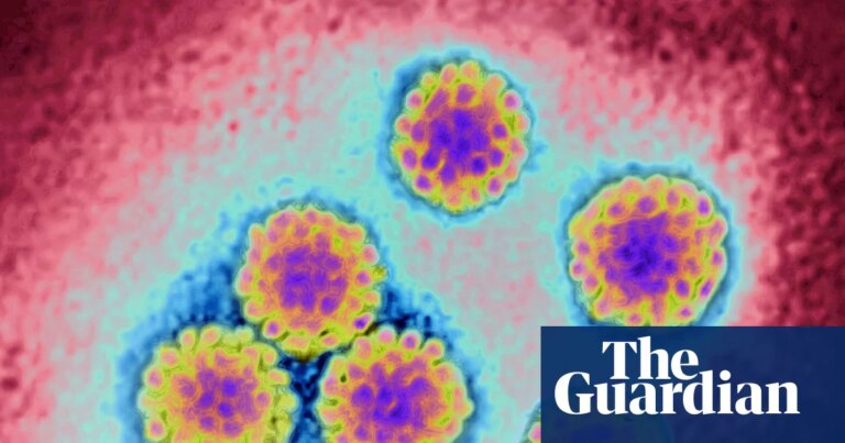 NHS England to offer women ‘gamechanging’ free home testing kits for cervical cancer | Cervical cancer NHS England to offer women ‘gamechanging’ free home testing kits for cervical cancer | Cervical cancer