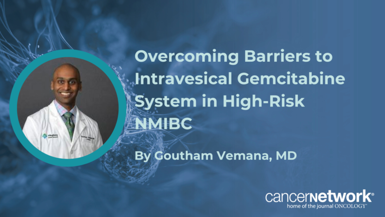 Overcoming Barriers to Intravesical Gemcitabine System in High-Risk NMIBC Overcoming Barriers to Intravesical Gemcitabine System in High-Risk NMIBC