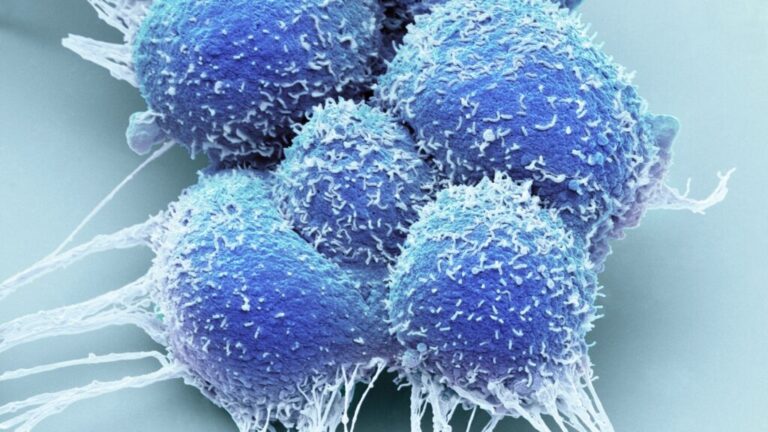 Science, risks and data behind focal therapy for prostate cancer Science, risks and data behind focal therapy for prostate cancer