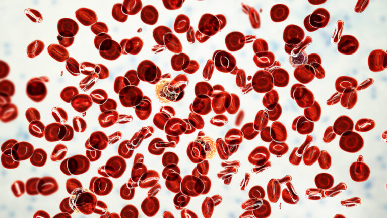 Silence Therapeutics blood cancer drug delivers strong results Silence Therapeutics blood cancer drug delivers strong results