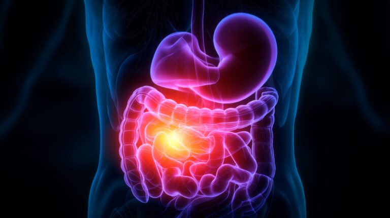 Sirexatamab Regimen May Improve PFS, OS in DKK1-High Colorectal Cancer Phase 1b study data show that izalontamab brengitecan produced a 48.1% objective response rate in previously treated extensive-stage small cell lung cancer.