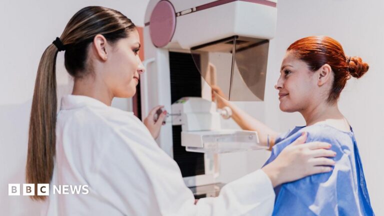 A female doctor doing mammogram exam on patient at hospital - stock photo. Both women have their hair tied back. The doctor is wearing a white lab coat and patient is wearing a blue gown.