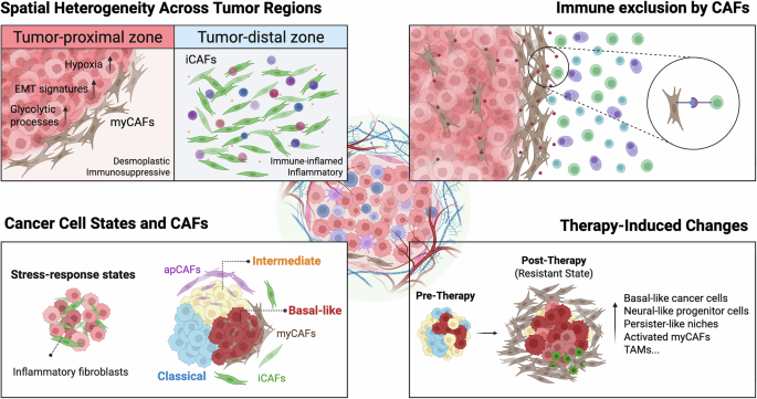 Spatially resolved tissue architecture and computational pathology in pancreatic cancer Spatially resolved tissue architecture and computational pathology in pancreatic cancer