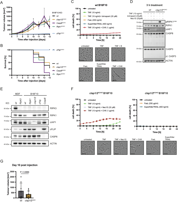 The anti-tumour activity of TNF in melanoma is determined by cFLIP The anti-tumour activity of TNF in melanoma is determined by cFLIP