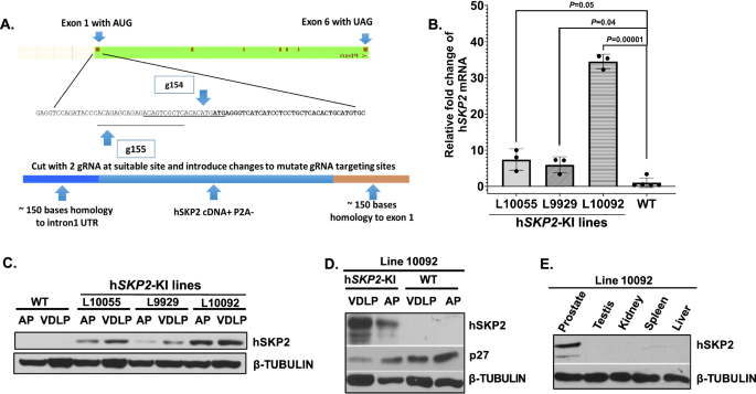 The establishment of prostate-specific, SKP2 humanized mice by CRISPR knock-in method reveals neoplastic initiation and microenvironmental reprogramming The establishment of prostate-specific, SKP2 humanized mice by CRISPR knock-in method reveals neoplastic initiation and microenvironmental reprogramming