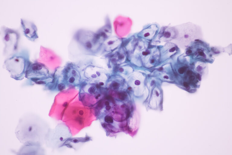 What does HPV self-testing mean for cervical screening in England? - Cancer Research UK