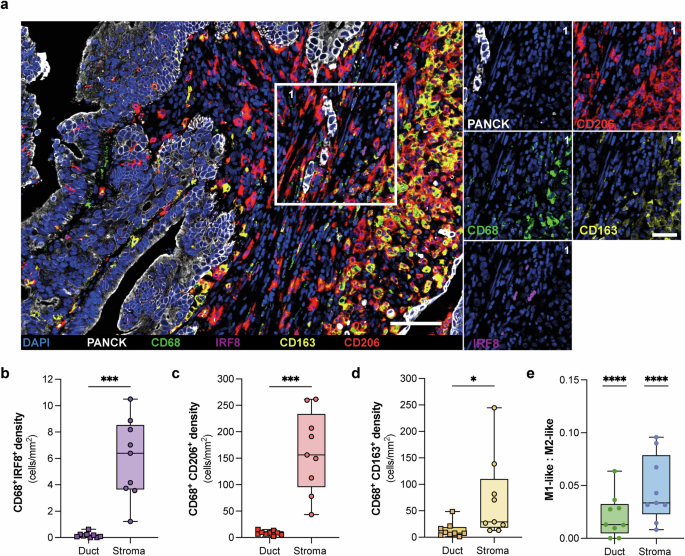 A pancreatic cancer organoid-macrophage co-culture using starPEG-heparin hydrogel deciphers tumor-immune cell interactions A pancreatic cancer organoid-macrophage co-culture using starPEG-heparin hydrogel deciphers tumor-immune cell interactions