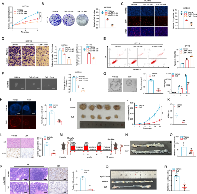 ADORA1 inhibition suppresses colon cancer development via hippo tumor suppressor pathway ADORA1 inhibition suppresses colon cancer development via hippo tumor suppressor pathway