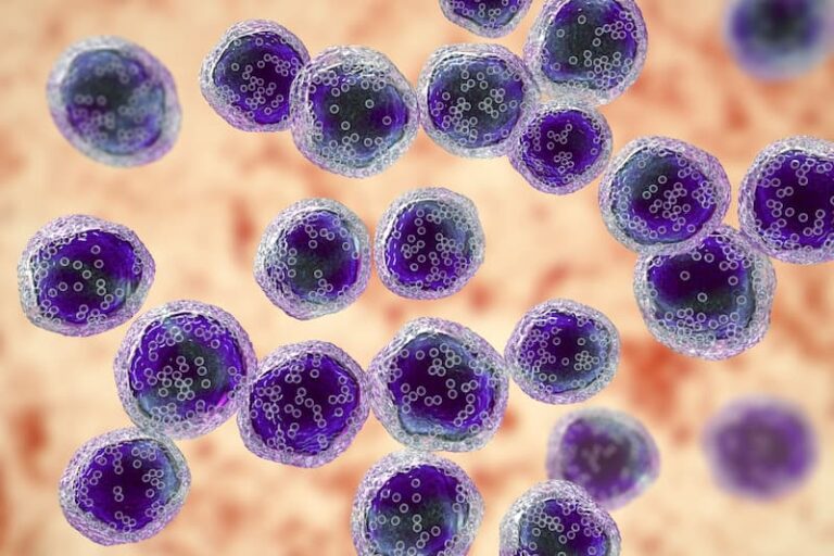 Azacitidine/Venetoclax Boosts Event-Free Survival in Induction-Eligible AML Azacitidine/Venetoclax Boosts Event-Free Survival in Induction-Eligible AML