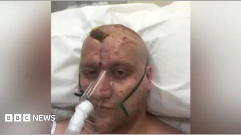 David Bown is pictured in a hospital bed wearing an oxygen mask after his brain cancer operation