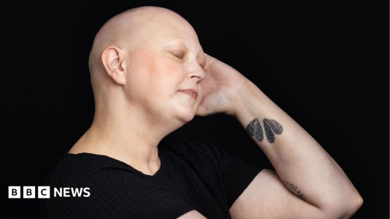 Rhiannon looking into the camera with a thoughtful expression on her face. She is almost completely bald.  She has a silver hoop nose ring and silver heart stud earrings.