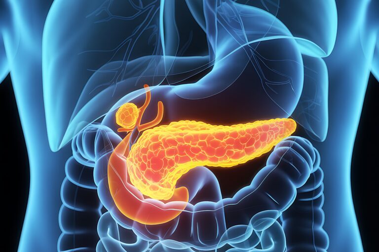 Daraxonrasib Receives FDA Breakthrough Therapy Status in 1L Metastatic PDAC