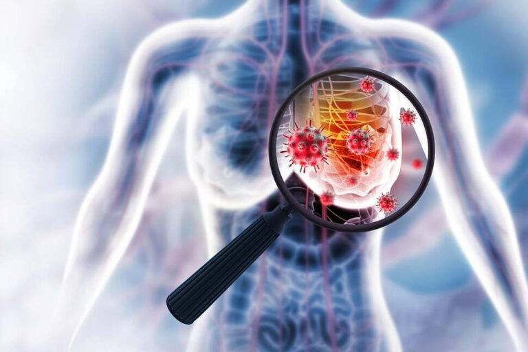 FDA Approves New Pill For Advanced Breast Cancer Guided By Blood Test FDA Approves New Pill For Advanced Breast Cancer Guided By Blood Test