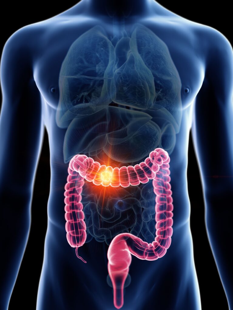 KST-6051 Receives Fast Track Designation in KRAS-Mutant Solid Tumors: © barinovalena - stock.adobe.com