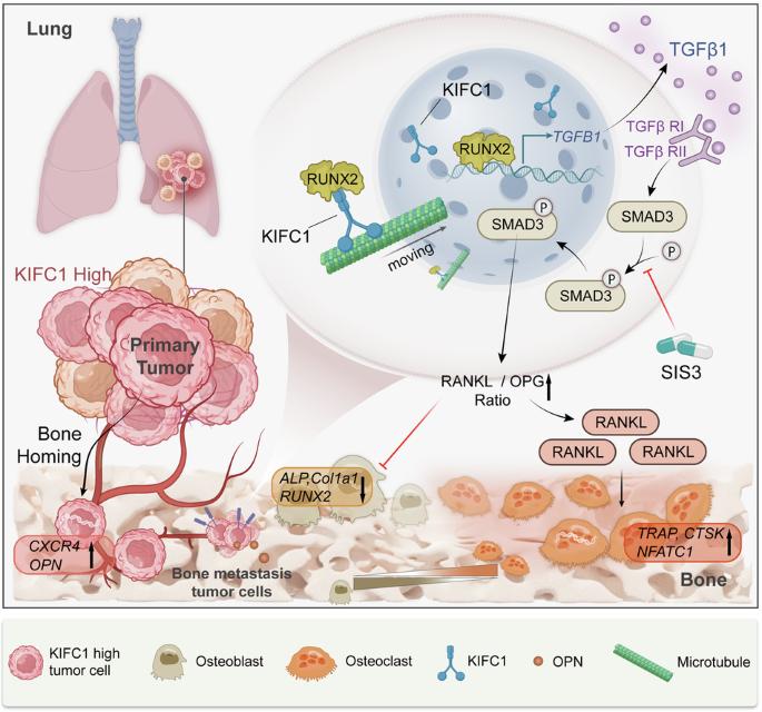 KIFC1 engages RUNX2/TGF-β signaling to promote lung cancer bone metastasis via disrupting bone homeostasis KIFC1 engages RUNX2/TGF-β signaling to promote lung cancer bone metastasis via disrupting bone homeostasis