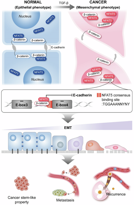 NFAT5 regulates TGF-β-induced epithelial-mesenchymal transition in breast cancer cells through interaction with β-catenin NFAT5 regulates TGF-β-induced epithelial-mesenchymal transition in breast cancer cells through interaction with β-catenin