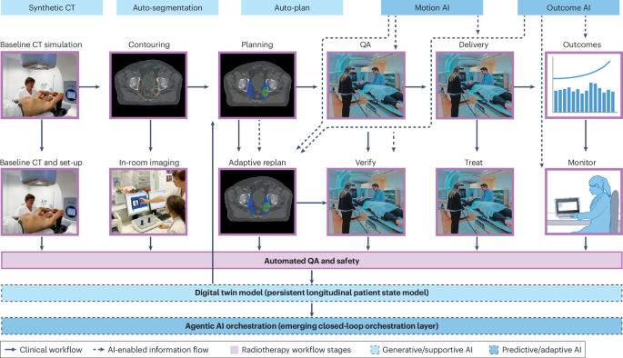 Optimizing the delivery of radiotherapy with artificial intelligence Optimizing the delivery of radiotherapy with artificial intelligence