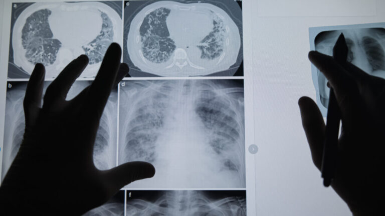 Professor uses personal cancer diagnosis to train future doctors