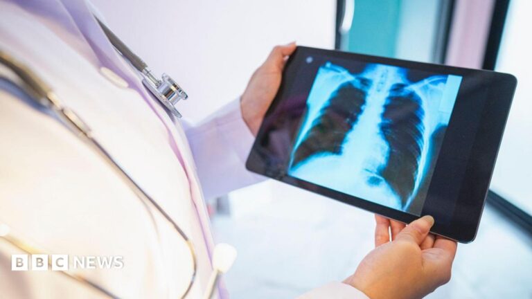 Shropshire lung cancer screening programme reaches 10,000 milestone Library image of a doctor in a white gown looking at a lung scan on a handheld device.