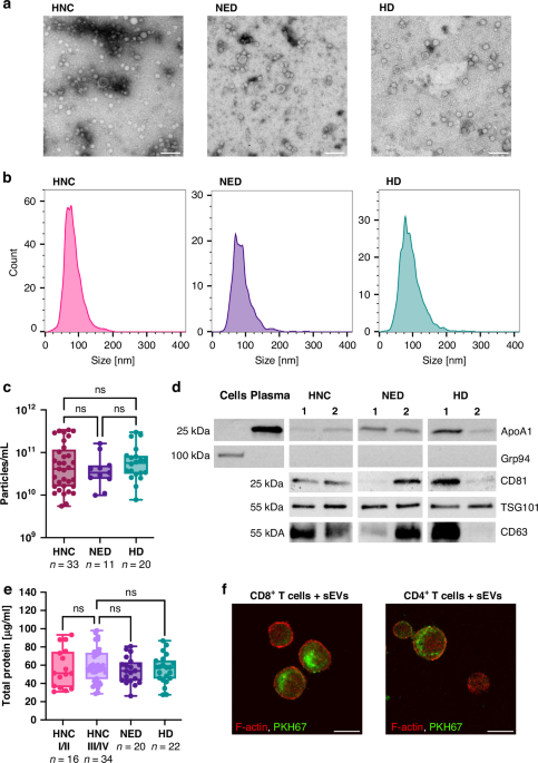 Small extracellular vesicles from the plasma of head and neck cancer patients induce dysfunctional T cell phenotypes Small extracellular vesicles from the plasma of head and neck cancer patients induce dysfunctional T cell phenotypes