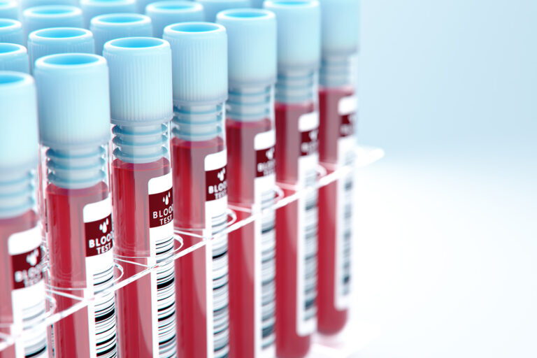 What’s next for liquid biopsy in cancer diagnosis and treatment? – Cancer Research UK What’s next for liquid biopsy in cancer diagnosis and treatment? - Cancer Research UK