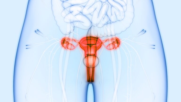 Fractionated SRS Improves Surgical Bed Control After Brain Metastasis Resection